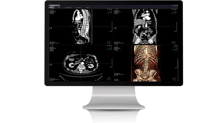 Mpr Volume Rendering Ulite 3D with native built in MIPS, MPR and 3D directly to your device ...