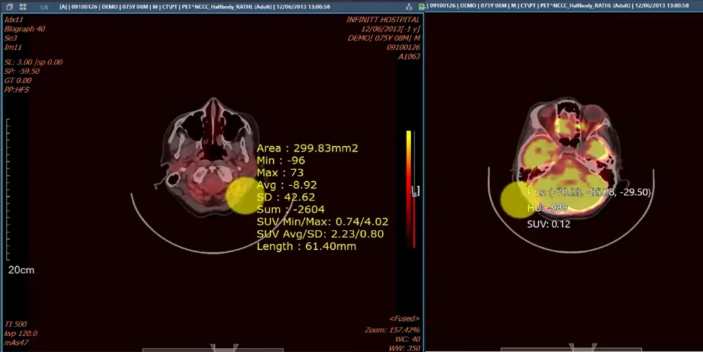 Continuum Systems CT PET Fusion Imaging 2
