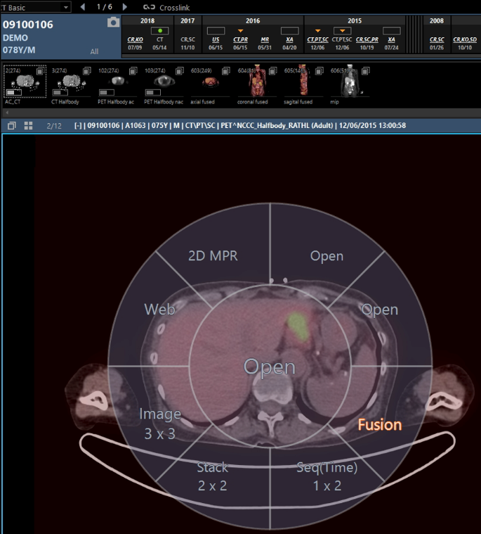Continuum Systems Image Comparisons Auto Synchronisation